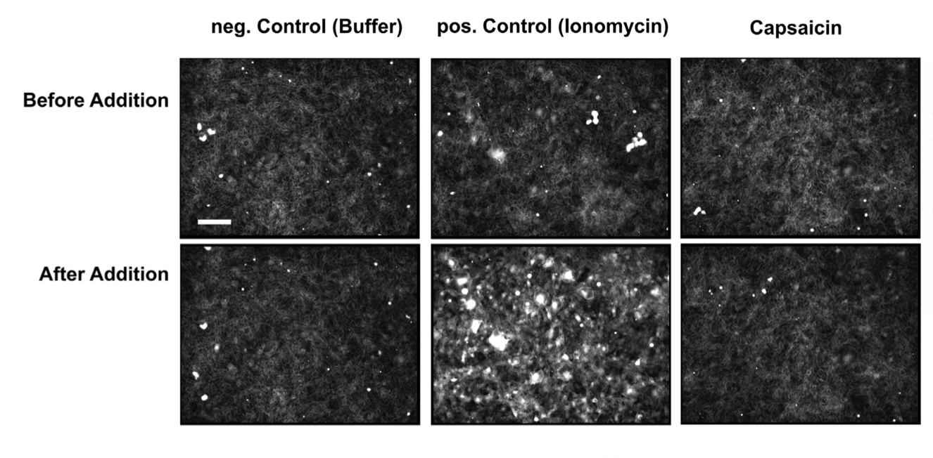 Image for The effect of capsaicin derivatives on tight-junction integrity and permeability of Madin-Darby canine kidney cells